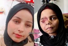 Nada Arhouma, Masa Kecil yang Direnggut Serpihan Peluru, Harapan yang Tertahan di Pintu Evakuasi