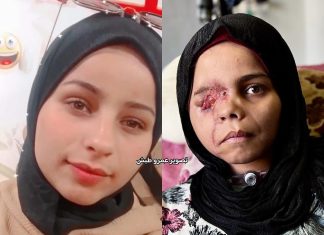 Nada Arhouma, Masa Kecil yang Direnggut Serpihan Peluru, Harapan yang Tertahan di Pintu Evakuasi