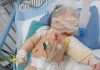 Khatib, Bayi 4 Bulan yang Kehilangan Kaki dan Dekapan Ibu di Bawah Reruntuhan
