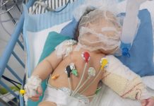 Khatib, Bayi 4 Bulan yang Kehilangan Kaki dan Dekapan Ibu di Bawah Reruntuhan