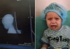 Keajaiban Medis: Dokter Gaza Operasi Bayi yang Kepalanya Ditembak Israel
