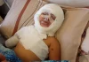 Bayi 3 Bulan ini Kena Serangan Udara Israel, Kini Divonis Tulis dan Bisu