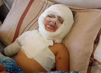 Bayi 3 Bulan ini Kena Serangan Udara Israel, Kini Divonis Tulis dan Bisu