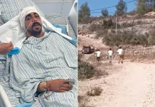 Tubuh Penuh Perban: Kisah Radwan Jadi Korban Terorisme Pemukim Yahudi di Ramallah