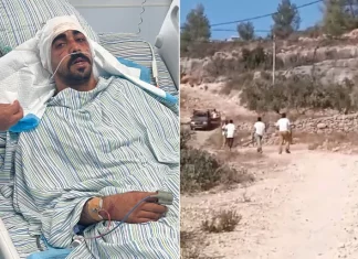 Tubuh Penuh Perban: Kisah Radwan Jadi Korban Terorisme Pemukim Yahudi di Ramallah