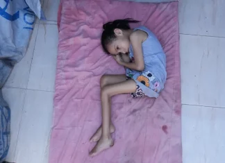 Tubuh Mungil Sila Menunduk Menahan Sakit: Bocah Gaza Terancam Lumpuh Permanen