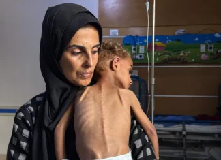 466 Warga Gaza Meninggal Dunia Akibat Kelaparan
